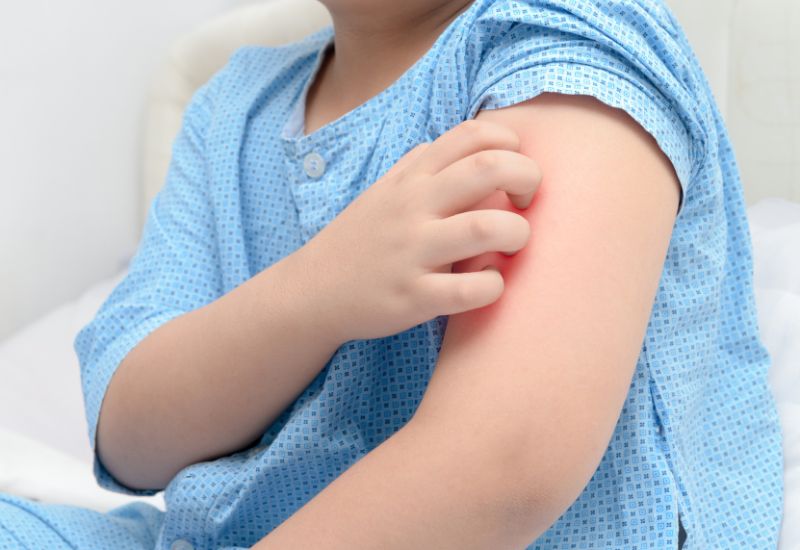 Is Itching a Sign of Healing or Infection Understanding Your Body’s Signals